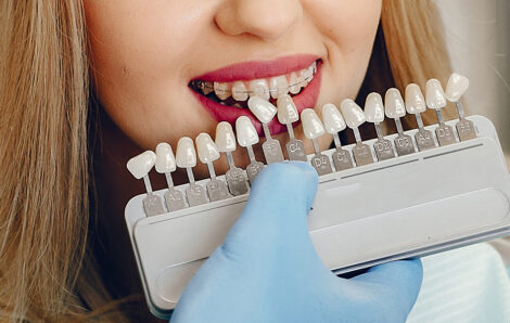 The Role of Veneers in Restoring Teeth Damaged by Trauma