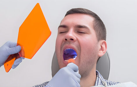 What Age Should You Get Your Wisdom Teeth Checked?