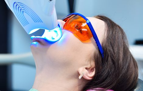 Best Teeth Whitening Options for Sensitive Teeth